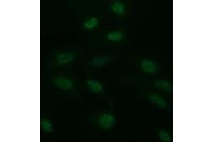 Image no. 4 for anti-CD163 (CD163) antibody (ABIN1497176) (CD163 antibody)