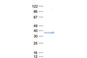 Validation with Western Blot (C21orf91 Protein (His tag))