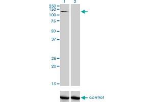 Western blot analysis of RNF111 over-expressed 293 cell line, cotransfected with RNF111 Validated Chimera RNAi (Lane 2) or non-transfected control (Lane 1). (RNF111 antibody  (AA 1-108))