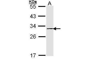 WB Image Sample (30 ug of whole cell lysate) A: A431 , 12% SDS PAGE antibody diluted at 1:1000