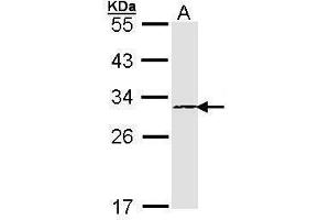 WB Image Sample (30 ug of whole cell lysate) A: A431 , 12% SDS PAGE antibody diluted at 1:1000 (PSMB4 antibody)