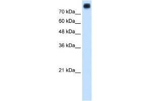 WB Suggested Anti-CDH3 Antibody Titration:  1.