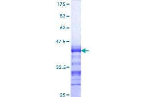 FOXP2 Protein (AA 616-715) (GST tag)