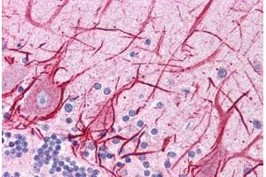 Human Brain, Cerebellum: Formalin-Fixed, Paraffin-Embedded (FFPE) (APOB antibody  (AA 4031-4080))