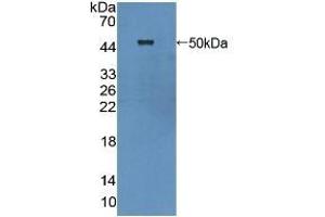 Detection of Recombinant CYTH1, Human using Polyclonal Antibody to Cytohesin 1 (CYTH1) (Cytohesin 1 antibody  (AA 1-398))