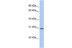 Western Blotting (WB) image for anti-TP53 Target 5 (TP53TG5) antibody (ABIN2459704) (TP53TG5 antibody)