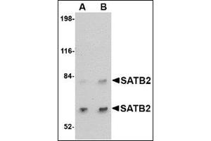 Western blot analysis of SATB2 in A20 cell lysate with this product at (A) 2 and (B) 4 μg/ml. (SATB2 antibody  (C-Term))