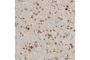 Immunohistochemical staining of human cerebral cortex with CC2D1B polyclonal antibody  shows moderate nuclear and cytoplasmic positivity in glial cells at 1:20-1:50 dilution.