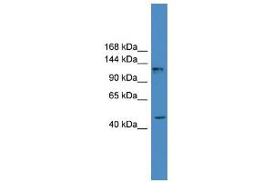 WB Suggested Anti-ADCY2 Antibody Titration:  0. (ADCY2 antibody  (Middle Region))