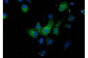 Anti-MGRN1 mouse monoclonal antibody (ABIN2454418) immunofluorescent staining of COS7 cells transiently transfected by pCMV6-ENTRY MGRN1 (RC208284). (Mahogunin RING Finger Protein 1 antibody)
