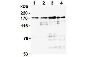 Western Blotting (WB) image for anti-Topoisomerase (DNA) II alpha 170kDa (TOP2A) (N-Term) antibody (ABIN1109282) (Topoisomerase II alpha antibody  (N-Term))