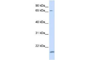 WB Suggested Anti-ZNF398 Antibody Titration:  0.