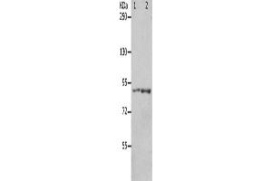 Gel: 8 % SDS-PAGE, Lysate: 40 μg, Lane 1-2: 293T cells, mouse brain tissue, Primary antibody: ABIN7191168(KCNC3 Antibody) at dilution 1/300, Secondary antibody: Goat anti rabbit IgG at 1/8000 dilution, Exposure time: 1 minute (KCNC3 antibody)