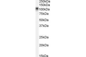 ABIN2561442 (0. (MYBL2 antibody  (C-Term))