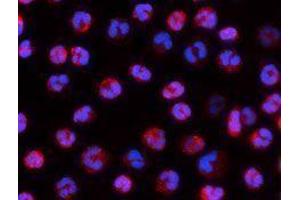 Immunofluorescence (IF) image for anti-Integrin alpha-L (ITGAL) antibody (Alexa Fluor 594) (ABIN2656812) (ITGAL antibody  (Alexa Fluor 594))