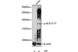 Western blot analysis of extracts of K562 cells, using Phospho-BCR-Y177 antibody (ABIN6135190, ABIN6136026, ABIN6136027 and ABIN6225622) at 1:1000 dilution. (BCR antibody  (pTyr177))