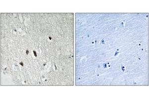 Immunohistochemistry analysis of paraffin-embedded human brain tissue, using RIPK2 (Ab-176) Antibody.
