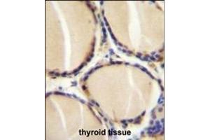 CALCA Antibody (Center) (ABIN655071 and ABIN2844701) immunohistochemistry analysis in formalin fixed and paraffin embedded human thyroid tissue followed by peroxidase conjugation of the secondary antibody and DAB staining. (CGRP antibody  (AA 56-83))