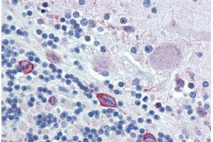 Anti-ERp72 antibody IHC staining of human brain, cerebellum. (PDIA4 antibody  (AA 623-638))