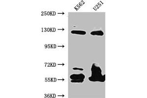 Western Blot Positive WB detected in: K562 whole cell lysate, U-251 whole cell lysate All lanes: BubR1 antibody at 1:1000 Secondary Goat polyclonal to rabbit IgG at 1/50000 dilution Predicted band size: 120, 106, 122 kDa Observed band size: 125 kDa (Recombinant BUB1B antibody)
