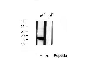 Western blot analysis of extracts of HepG2 cells, using CHCHD2 antibody. (CHCHD2 antibody  (Internal Region))