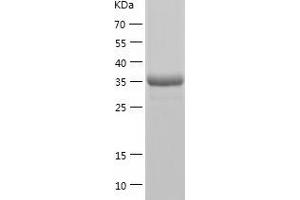 Western Blotting (WB) image for Hexamethylene Bis-Acetamide Inducible 1 (HEXIM1) (AA 1-359) protein (His tag) (ABIN7284701) (HEXIM1 Protein (AA 1-359) (His tag))