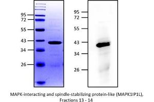 Western Blotting (WB) image for Mitogen-Activated Protein Kinase 1 Interacting Protein 1-Like (MAPK1IP1L) (AA 2-245) protein (His tag) (ABIN3103674) (MAPK1IP1L Protein (AA 2-245) (His tag))