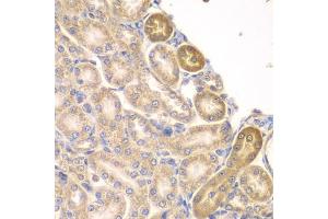 Immunohistochemistry of paraffin-embedded rat kidney using PIP4K2A antibody (ABIN6130624, ABIN6145673, ABIN6145674 and ABIN6223324) at dilution of 1:100 (40x lens). (PIP4K2A antibody  (AA 120-350))