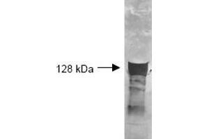 Both the antiserum and IgG fractions of anti-Glycerol Kinase (Cellulomonas) are shown to detect the 128,000 dalton enzyme in cellular extracts. (Glycerol Kinase antibody)
