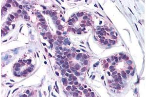 Human Breast: Formalin-Fixed, Paraffin-Embedded (FFPE) (MFI2 antibody  (N-Term))