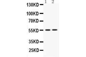 Western blot analysis of VRK1 expression in rat thymus extract ( Lane 1) and JURKAT whole cell lysates ( Lane 2). (VRK1 antibody  (C-Term))