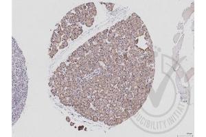 Immunohistochemistry (IHC) image for anti-Eukaryotic Translation Initiation Factor 4E (EIF4E) (AA 121-217) antibody (ABIN1386772)