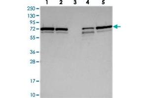 Western blot analysis of Lane 1: RT-4, Lane 2: U-251 MG, Lane 3: Human Plasma, Lane 4: Liver, Lane 5: Tonsil with SNX2 polyclonal antibody  at 1:250-1:500 dilution. (Sorting Nexin 2 antibody)