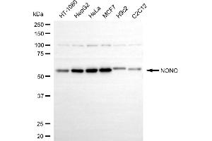 Western blotting analysis using NONO antibody (ABIN7799619).