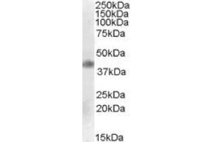 Image no. 1 for anti-Meis Homeobox 1 (MEIS1) (Internal Region) antibody (ABIN375073) (MEIS1 antibody  (Internal Region))
