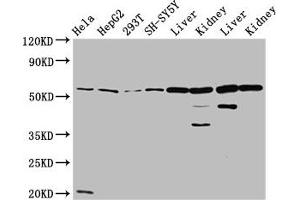 Western Blot Positive WB detected in: Hela whole cell lysate, HepG2 whole cell lysate, 293T whole cell lysate, SH-SY5Y whole cell lysate, Rat liver tissue, Rat kidney tissue, Mouse liver tissue, Mouse kidney tissue All lanes: ALDH7A1 antibody at 4. (ALDH7A1 antibody  (AA 386-515))