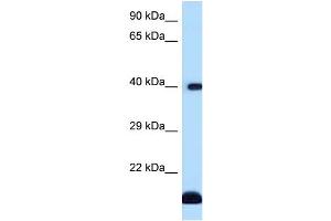 WB Suggested Anti-CD1D Antibody Titration: 1. (CD1d antibody  (C-Term))
