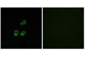 Immunofluorescence analysis of HUVEC cells, using CLCN4 antibody. (CLCN4 antibody)