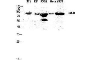 Western Blot (WB) analysis of 3T3 KB K562 HeLa 293T lysis using Raf-B antibody. (BRAF antibody  (Ser188))