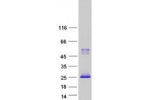 Validation with Western Blot (RHOC Protein (Transcript Variant 3) (Myc-DYKDDDDK Tag))