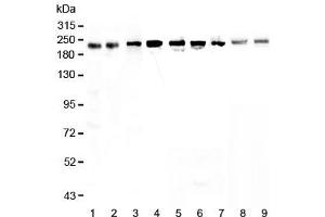Western blot testing of human 1) HeLa, 2) placenta, 3) MCF7, 4) A549, 5) A431, 6) SGC-7901, 7) 22RV1, 8) rat small intestine and 9) mouse small intestine lysate with BRG1 antibody at 0. (SMARCA4 antibody)