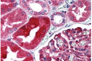 Human Kidney (formalin-fixed, paraffin-embedded) stained with TJP1 antibody ABIN305736 at 5 ug/ml followed by biotinylated goat anti-rabbit IgG secondary antibody ABIN481713, alkaline phosphatase-streptavidin and chromogen. (TJP1 antibody  (AA 463-1109))