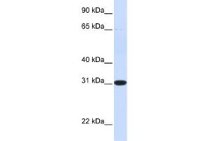 WB Suggested Anti-PBLD Antibody Titration: 0.