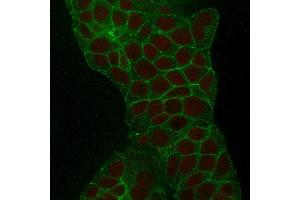 Confocal Immunofluorescence of MCF-7 cells TACSTD2 / TROP2 Mouse Monoclonal Antibody (TACSTD2/2152).