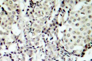 Image no. 1 for anti-Mitogen-Activated Protein Kinase Kinase 3 (MAP2K3) antibody (ABIN265520) (MAP2K3 antibody)