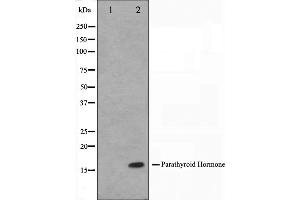 Western blot analysis on A549 cell lysate using Parathyroid Hormone Antibody. (PTH antibody  (Internal Region))