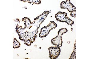 Anti-CUEDC2 antibody, IHC(P) IHC(P): Human Thyroid Cancer Tissue