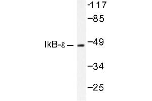Image no. 1 for anti-Nuclear Factor of kappa Light Polypeptide Gene Enhancer in B-Cells Inhibitor, epsilon (NFKBIE) antibody (ABIN265484) (NFKBIE antibody)