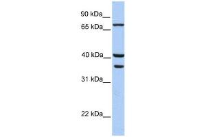 Transglutaminase 5 antibody used at 1 ug/ml to detect target protein. (Transglutaminase 5 antibody  (C-Term))