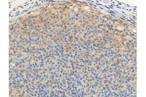 ABIN6256325 and ABIN6267117 at 1/100 staining Rat ovarian tissue by IHC-P. (FOXO3 antibody  (pSer413))